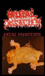 Brutal Dissection : Fatal Infection